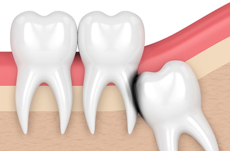 General Dentist Services Dental Care of Michigan